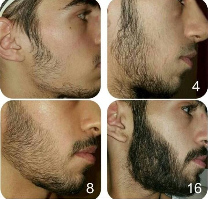 barba